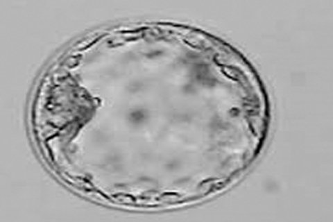 Blastocyst Transfer