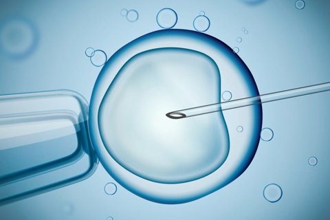 Intracytoplasmic Sperm Injection (ICSI)